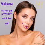 رویترین والیوم